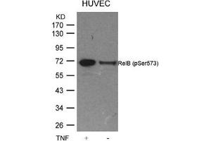 Western blot analysis of extracts from HUVEC cells untreated or treated with TNF using RelB(Phospho-Ser573) Antibody. (RELB Antikörper  (pSer573))