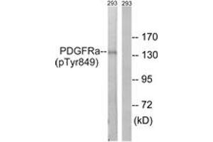 Western blot analysis of extracts from 293 cells, using PDGFRa (Phospho-Tyr849) Antibody. (PDGFRA Antikörper  (pTyr849))