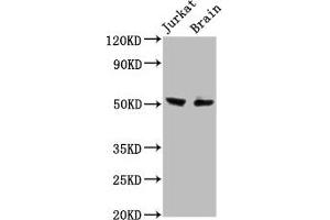 Western Blot Positive WB detected in: Jurkat whole cell lysate, Rat brain tissue All lanes: ONECUT1 antibody at 7. (ONECUT1 Antikörper  (AA 192-292))
