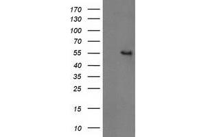 Western Blotting (WB) image for anti-Glucosidase, Beta, Acid 3 (Cytosolic) (GBA3) (AA 1-150), (AA 370-469) antibody (ABIN1490582) (GBA3 Antikörper  (AA 1-150, AA 370-469))