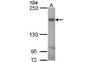 WB Image Sample (30 ug of whole cell lysate) A: JurKat 5% SDS PAGE antibody diluted at 1:1000