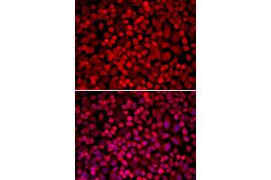 Immunofluorescence analysis of U20S cell using NCOA1 antibody. (NCOA1 Antikörper)