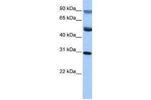 Western Blotting (WB) image for anti-GID Complex Subunit 4, VID24 Homolog (GID4) antibody (ABIN2459711) (GID4 Antikörper)