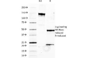 SDS-PAGE Analysis Purified HLA-B Mouse Monoclonal Antibody (JOAN-1). (HLA-B Antikörper)