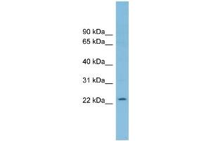 WB Suggested Anti-RNF125 Antibody Titration: 0. (RNF125 Antikörper  (Middle Region))