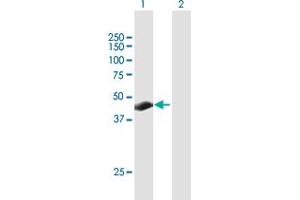 Western Blot analysis of TSPYL3 expression in transfected 293T cell line by TSPYL3 MaxPab polyclonal antibody. (TSPY-Like 3 Antikörper  (AA 1-355))