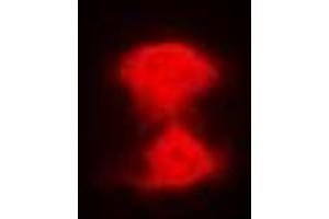 Immunofluorescent analysis of AIPL1 staining in Hela cells. (AIPL1 Antikörper)