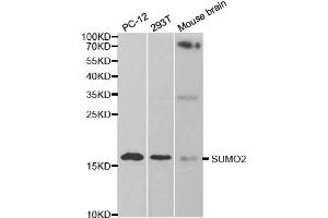 Western blot analysis of extracts of various cell lines, using SUMO2 antibody. (SUMO2 Antikörper)