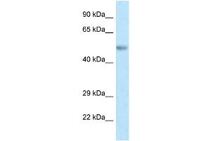 WB Suggested Anti-Pax8 Antibody Titration: 1. (PAX8 Antikörper  (C-Term))