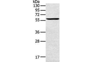 Western Blotting (WB) image for anti-Spermatogenesis Associated 6 (SPATA6) antibody (ABIN2428883) (SPATA6 Antikörper)