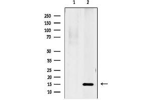 anti-GABA(A) Receptor-Associated Protein-Like 2 (GABARAPL2) (N-Term) antibody