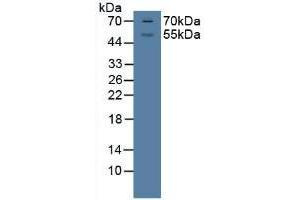 Detection of GR in Porcine Brian Tissue using Polyclonal Antibody to Glucocorticoid Receptor (GR) (Glucocorticoid Receptor Antikörper  (AA 598-755))