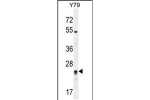 Western blot analysis in Y79 cell line lysates (35ug/lane). (DPCD Antikörper  (AA 96-136))