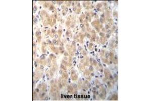 Immunohistochemistry (Paraffin-embedded Sections) (IHC (p)) image for anti-Poly(A) Binding Protein, Nuclear 1-Like (Cytoplasmic) (PABPN1L) (AA 166-194) antibody (ABIN655857)