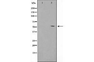 Western blot analysis on HuvEc cell lysate using TINF2 Antibody,The lane on the left is treated with the antigen-specific peptide.