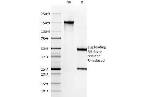 SDS-PAGE Analysis Purified SM-MHC Monoclonal Antibody (SMMS-1). (MYH11 Antikörper)