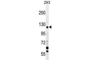 TRPM8 Antibody (Center) western blot analysis in 293 cell line lysates (35 µg/lane). (TRPM8 Antikörper  (Middle Region))