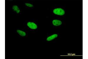 Immunofluorescence of purified MaxPab antibody to ING5 on HeLa cell. (ING5 Antikörper  (AA 1-240))