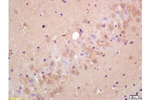 Formalin-fixed and paraffin embedded rat brain labeled with Anti-MRGX1/MRGPRC/SNSR Polyclonal Antibody, Unconjugated (ABIN718751) at 1:200 followed by conjugation to the secondary antibody and DAB staining. (MRGPRX1/3/4 (AA 21-120) Antikörper)