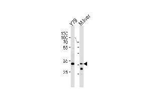 Western blot analysis in Y79 cell line and mouse liver lysates (35ug/lane). (CSDA Antikörper  (AA 152-181))