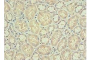 Immunohistochemistry of paraffin-embedded human kidney tissue using ABIN7142338 at dilution of 1:100 (PDPK1 Antikörper  (AA 277-556))