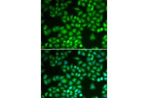 Immunofluorescence analysis of A549 cells using NFKB1 antibody (ABIN5974018). (NFKB1 Antikörper)