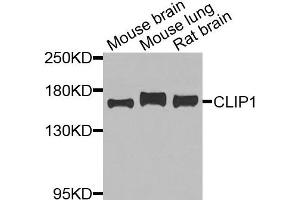 Western blot analysis of extracts of various cells, using CLIP1 antibody. (CLIP1 Antikörper)