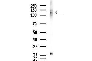 anti-Transforming Growth Factor, beta Receptor III (TGFBR3) (C-Term) antibody