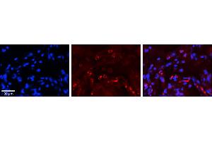 Rabbit Anti-GAA Antibody     Formalin Fixed Paraffin Embedded Tissue: Human Lung Tissue  Observed Staining: Cytoplasmic in alveolar type I cells  Primary Antibody Concentration: 1:100  Other Working Concentrations: 1/600  Secondary Antibody: Donkey anti-Rabbit-Cy3  Secondary Antibody Concentration: 1:200  Magnification: 20X  Exposure Time: 0. (GAA Antikörper  (N-Term))