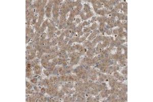 Immunohistochemical staining of human ovary with C9 polyclonal antibody  shows strong cytoplasmic positivity in follicle cells at 1:10-1:20 dilution. (C9 Antikörper)