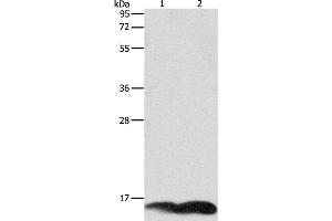 Western Blot analysis of A549 and Jurkat cell using PFN1 Polyclonal Antibody at dilution of 1:1000 (PFN1 Antikörper)
