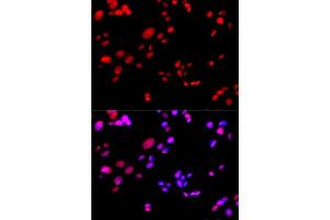 Immunofluorescence analysis of GFP-RNF168 transgenic U2OS cells using RPA2 antibody. (RPA2 Antikörper  (AA 80-270))