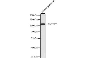 Western blot analysis of extracts of mouse pancreas, using DNTTIP2 antibody (ABIN7266732) at 1:1000 dilution. (DNTTIP2 Antikörper  (AA 1-300))