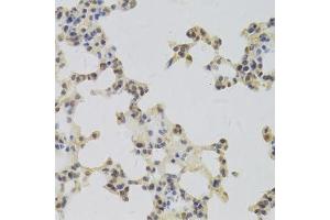 Immunohistochemistry (Paraffin-embedded Sections) (IHC (p)) image for anti-Hepatoma-Derived Growth Factor (HDGF) (AA 1-240) antibody (ABIN6141694)