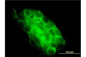 Immunofluorescence of monoclonal antibody to USP31 on A-431 cell. (USP31 Antikörper  (AA 1254-1352))