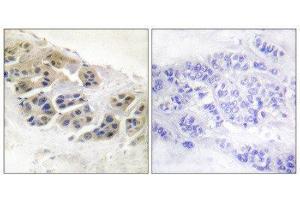 Immunohistochemistry (IHC) image for anti-Mammaglobin (Internal Region) antibody (ABIN1848654) (Mammaglobin Antikörper  (Internal Region))