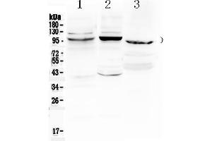 Western blot analysis of ATF6 using anti- ATF6 antibody . (ATF6 Antikörper  (C-Term))