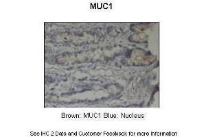 Sample Type :  Pig stomach  Primary Antibody Dilution :  1:500  Secondary Antibody :  Anti-rabbit-HRP  Secondary Antibody Dilution :  1:1000  Color/Signal Descriptions :  Brown: MUC1 Blue: Nucleus  Gene Name :  MUC1  Submitted by :  Dr. (MUC1 Antikörper  (C-Term))