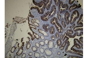 Immunohistochemistry (IHC) image for anti-Keratin 20 (KRT20) (AA 408-424), (C-Term) antibody (ABIN870620) (KRT20 Antikörper  (C-Term))