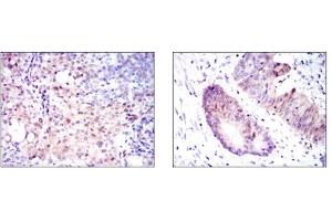Immunohistochemistry (IHC) image for anti-Argininosuccinate Synthase 1 (ASS1) antibody (ABIN1105455) (ASS1 Antikörper)