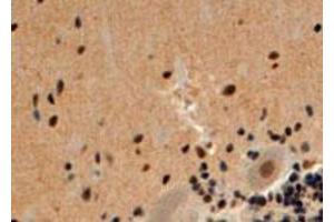 ARRB2 polyclonal antibody  (4 ug/mL) staining of paraffin embedded human cerebellum. (Arrestin 3 Antikörper  (Internal Region))