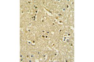 Formalin-fixed and paraffin-embedded human brain tissue with PAX6 Antibody , which was peroxidase-conjugated to the secondary antibody, followed by DAB staining. (PAX6 Antikörper  (AA 183-210))
