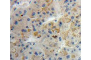 Used in DAB staining on fromalin fixed paraffin-embedded liver tissue (ANG Antikörper  (AA 25-147))