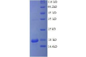 Interleukin 15 (IL15) (AA 49-162), (full length) protein (His tag)