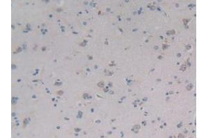 IHC-P analysis of Human Brain Tissue, with DAB staining. (PCOLCE2 Antikörper  (AA 297-415))
