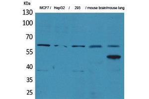 Western Blotting (WB) image for anti-Zinc Finger Protein 307 (ZKSCAN4) (Internal Region) antibody (ABIN3178345) (ZKSCAN4 Antikörper  (Internal Region))