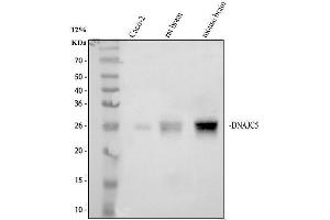 Western blot analysis of DNAJC5 using anti-DNAJC5 antibody (ABIN7600469).