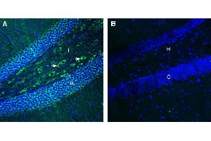 Expression of FLRT3 in mouse hippocampus. (FLRT3 Antikörper  (Extracellular))