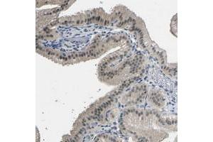 Immunohistochemical staining of human gallbladder with GPR158 polyclonal antibody  shows weak nuclear positivity in glandular cells. (GPR158 Antikörper)
