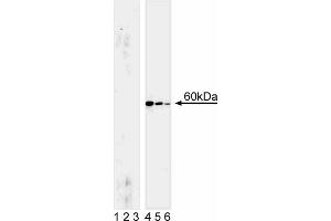 Western blot analysis for Akt (pS472/pS473). (AKT1 Antikörper  (pSer472))